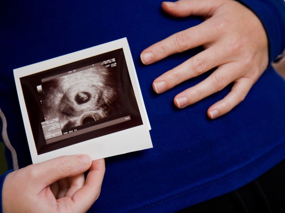 siêu âm thai và những điều cần biết