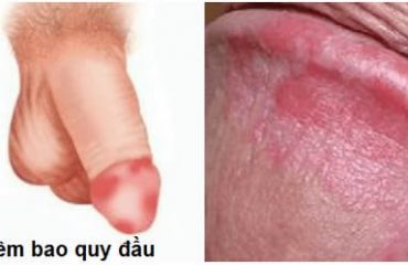 ngua-rat-bao-quy-dau-dau-hieu-canh-bao-cua-nhieu-benh-ly-nguy-hiem