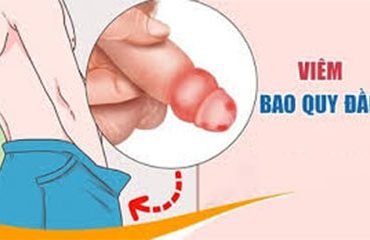 viem-bao-quy-dau-phai-chua-ngay-neu-khong-muon-vo-sinh