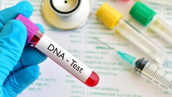 Xét nghiệm DNA để nhận biết giới tính thai nhi
