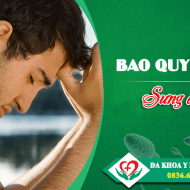 bao-quy-dau-bi-sung-do-la-bi-lam-sao