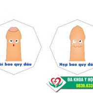 cach-phan-biet-dai-bao-quy-dau-va-hep-bao-quy-dau