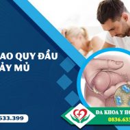 cat-bao-quy-dau-bi-chay-mu-co-sao-khong