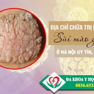dia-chi-chua-benh-sui-mao-ga-o-ha-noi