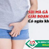 sui-mao-ga-o-giai-doan-dau-co-ngua-khong