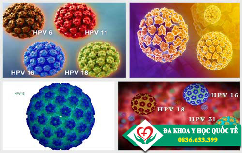 Virus HPV gây sùi mào gà ở trẻ em 